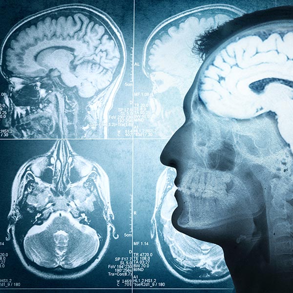 ניתוחי גידולי מוח