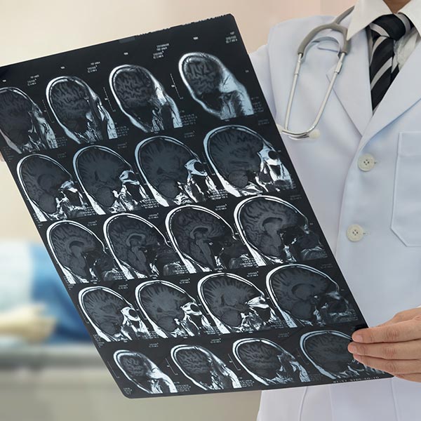 ניתוחי דלף-shunt