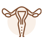 ניתוחים גינקולוגיים