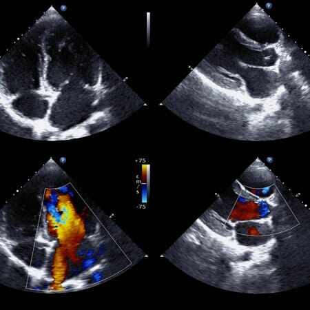 ecografias pélvicas beja