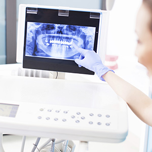 טיפולי שיניים בהסדר עם חברות הביטוח