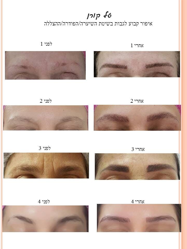 שיטת השיערה 44