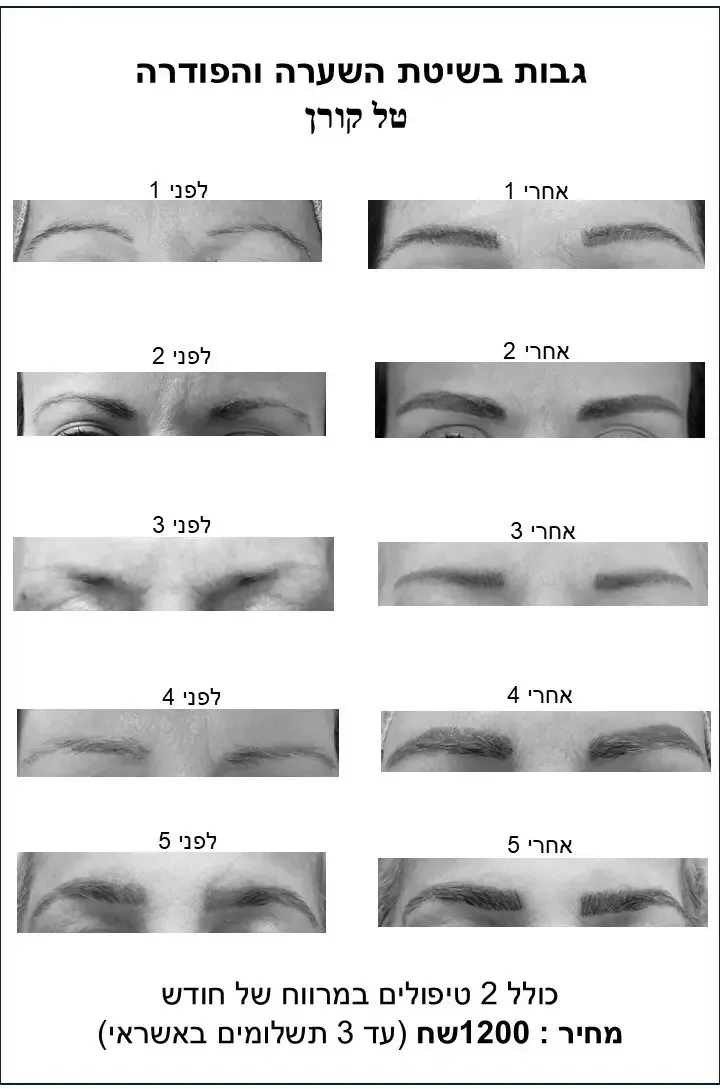 שיטת השיערה 44