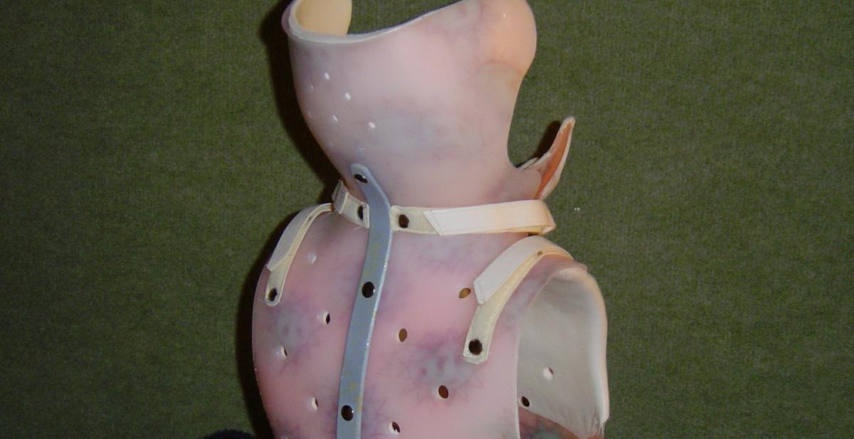 Orthèse Minerve base thoracique - Orthopédie Yvernogeau à Caen