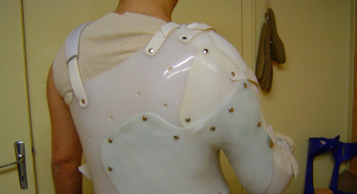 ORTHESES CORSET EN PLASTIQUE SEMI-SOUPLE  YVERNOGEAU CAEN