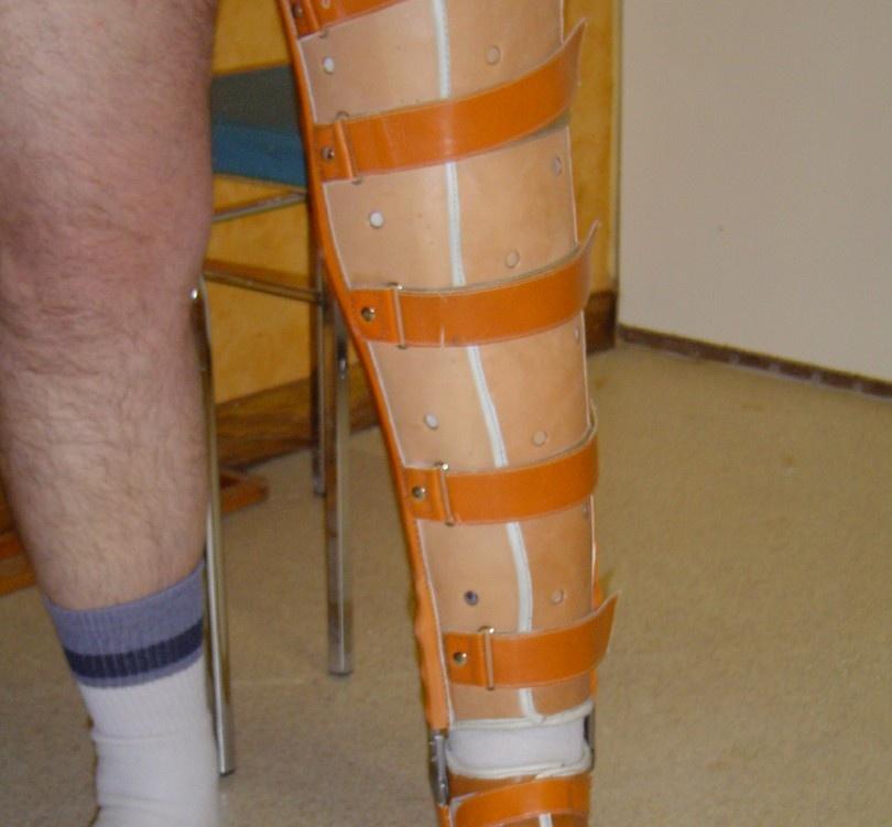 Genouillère rigide ou articulée Cuir, plastique - Orthopédie Yvernogeau à Caen