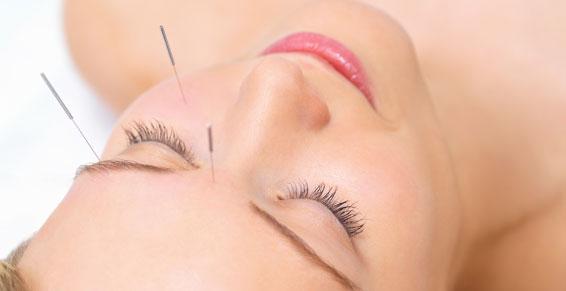 Médecine générale : orientation acupuncture