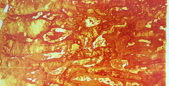 Angoisses, mal de vivre