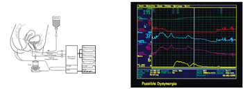 Ουροδυναμικός έλεγχος