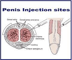 Δοκιμασία στύσης