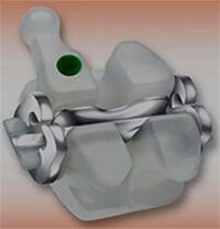 סמכים ננעלים שקופיםיים