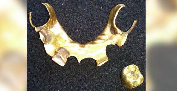 Rachat d'or dentaire