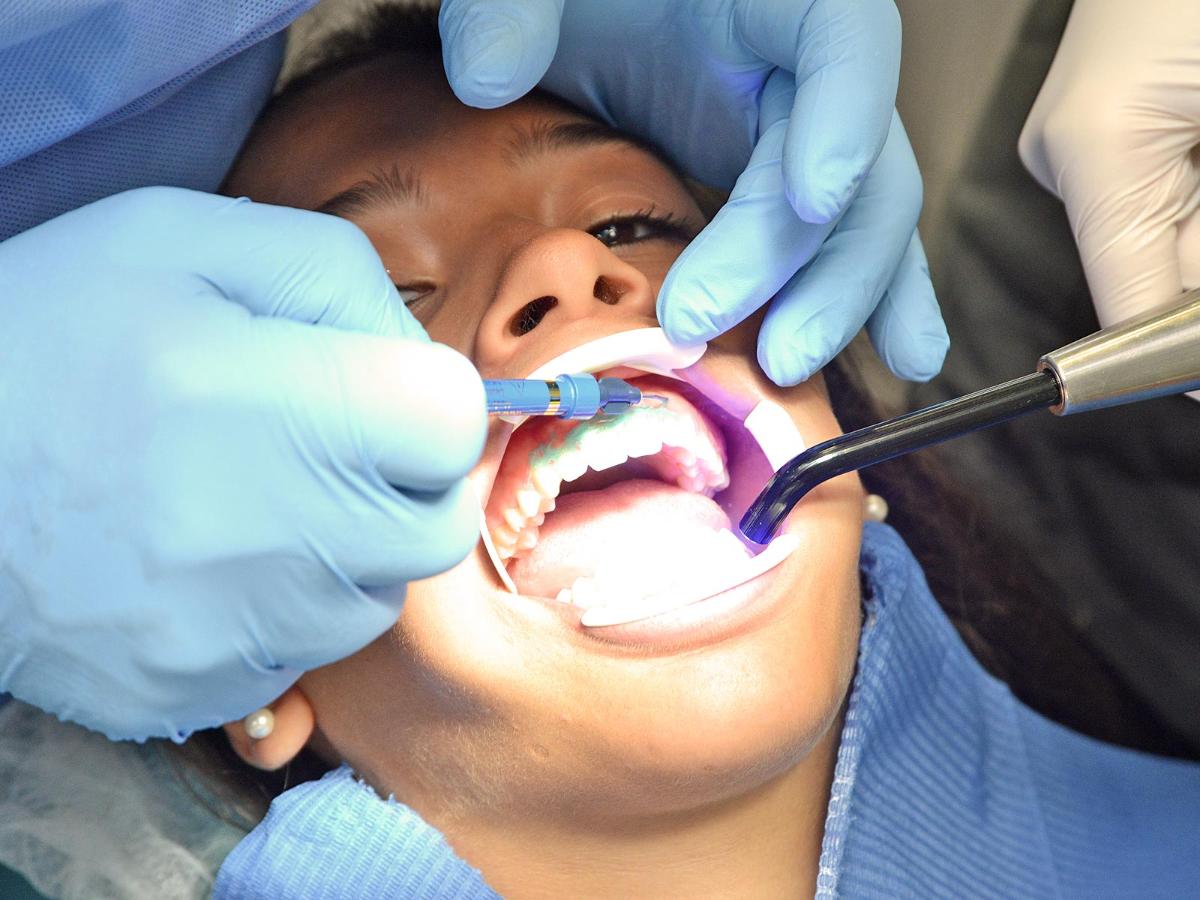 Blanchiment Vital Laser à la Clinique Dentaire Trocadéro à Paris