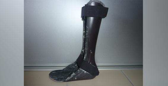 Tous types d'attelles - Stabilisation du pied à notre cabinet situé à Vouneuil sous Biard