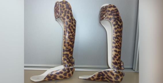 Notre cabinet Orthopédie Pasquay fabrique en mesure adaptée