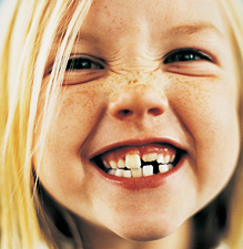 טיפול בשיני חלב