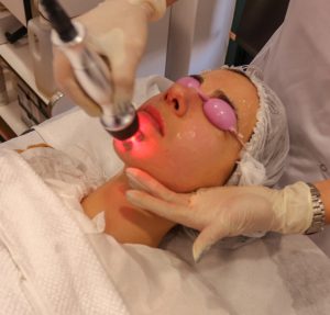 Tratamento Rosto - Radiofrequencia