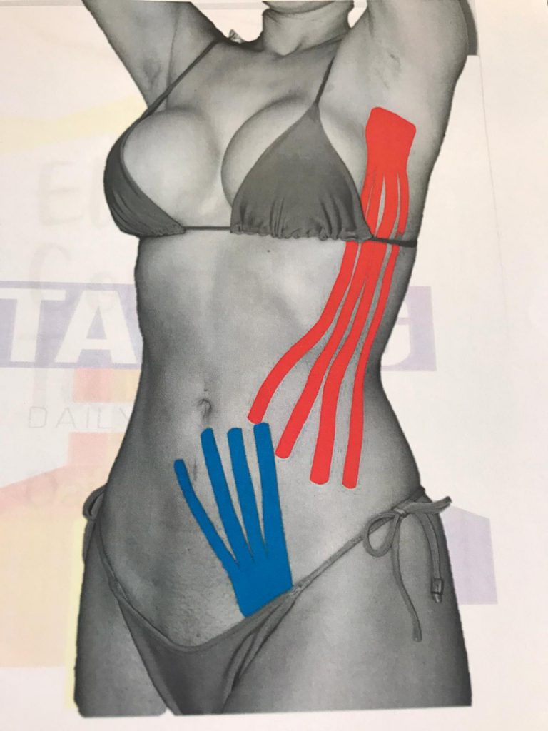 Taping - Kinesio (fitas adesivas)