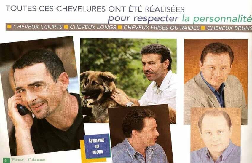 Implantes Cabelo Homem