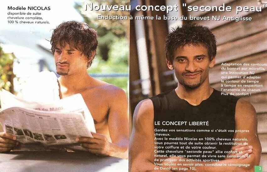 Implante Cabelos Homem