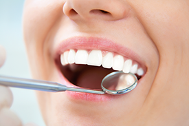 אסתטיקה דנטלית